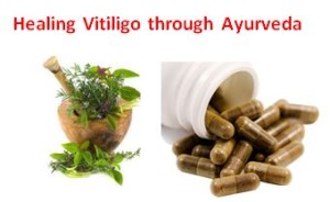 Ayurvedic treatment for leucoderma